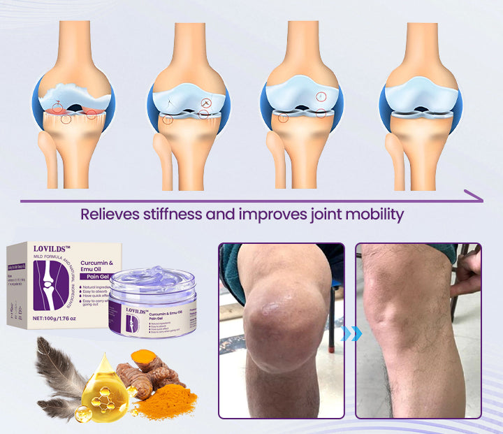LOVILDS™ Curcumin & Emu Oil Pain Gel – 🏥Backed by US Osteopathic Experts