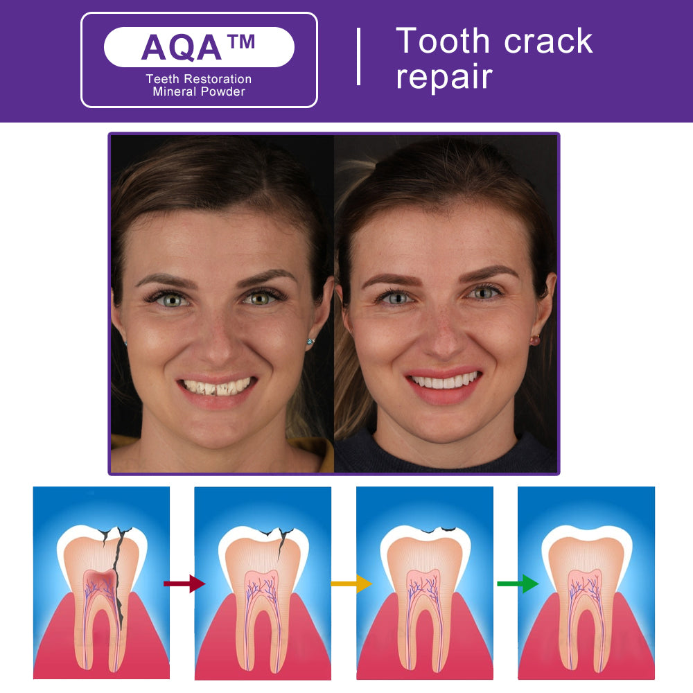 Official Store🏥🏥 AQA™ Teeth Restoration Mineral Powder  (ADA recommended) MADE IN USA (🎁Flash Sale - Don’t Miss Out)