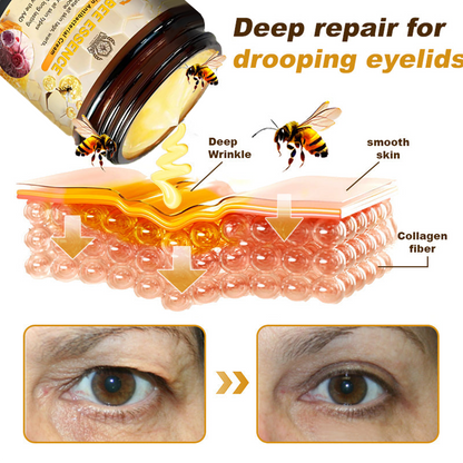 LOVILDS™ Bee Essence Skin Antibacterial Cream—used to treat a variety of skin diseases (AAD recommended)