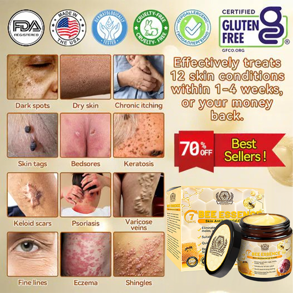 LOVILDS™ Bee Essence Skin Antibacterial Cream—used to treat a variety of skin diseases (AAD recommended)
