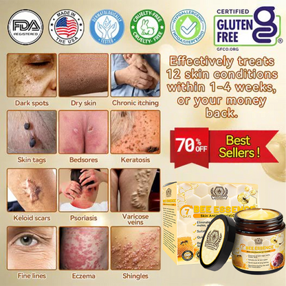 LOVILDS™ Bee Essence Skin Antibacterial Cream—used to treat a variety of skin diseases (AAD recommended)
