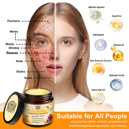 LOVILDS™ Bee Essence Skin Antibacterial Cream—used to treat a variety of skin diseases (AAD recommended)