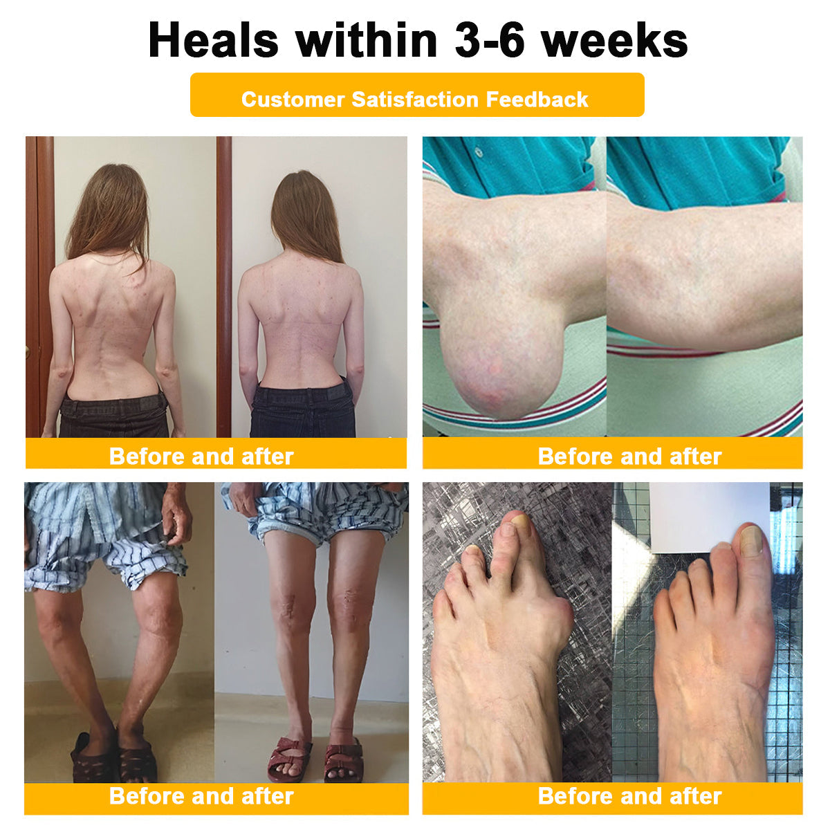 AQA™ Botulinum & Bee Essence Pain-Relief Bone Healing Cream