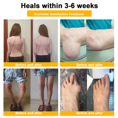 AQA™ Botulinum & Bee Essence Pain-Relief Bone Healing Cream