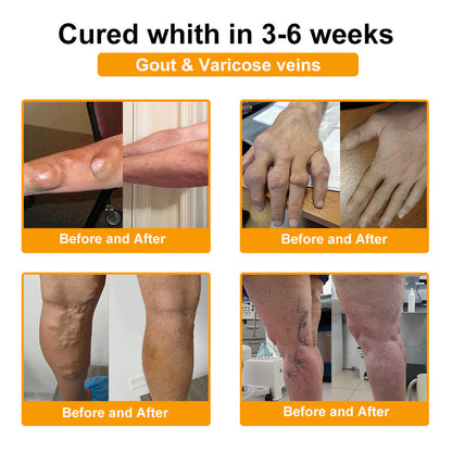 AQA™ Botulinum & Bee Essence Pain-Relief Bone Healing Cream