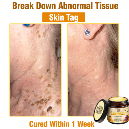 LOVILDS™ Bee Essence Skin Antibacterial Cream—used to treat a variety of skin diseases (AAD recommended)