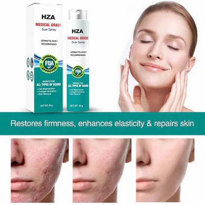 HZA Advanced Scar Spray For All Types of Scars - For example Acne Scars, Surgical Scars and Stretch Marks ⚡️⚡️⚡️