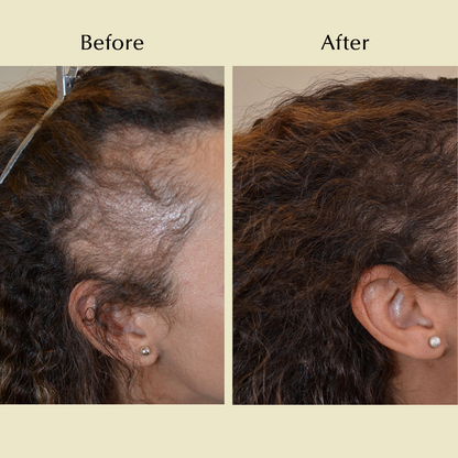 🔥DIYSTAR - Natural Hair Growth Oil