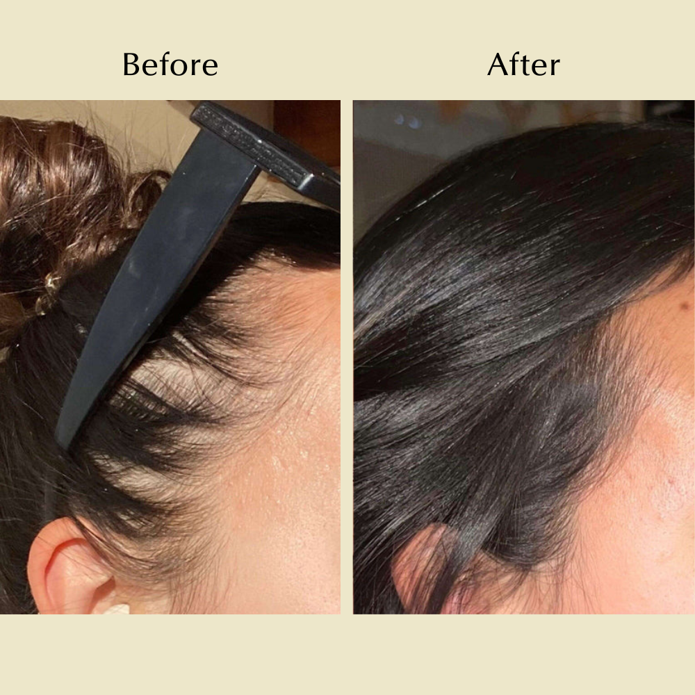 🔥DIYSTAR - Natural Hair Growth Oil