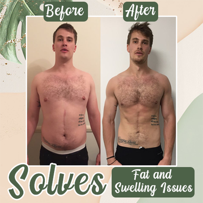 HZA  Perfect Detox Slimming Patch（Limited Time Discount 🔥 Last Day）