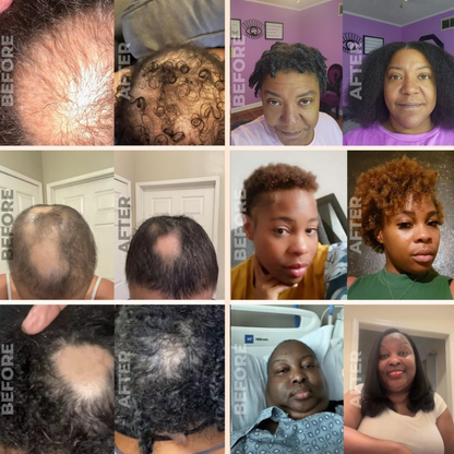 🔥DIYSTAR - Natural Hair Growth Oil